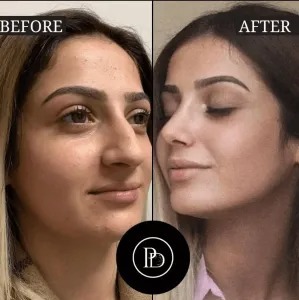 Is PRP Treatment in Dubai Worth It? A Full Breakdown